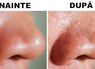 6 Lucruri dăunătoare pe care șervețelele demachiante le pot face pielii tale