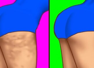 7 secrete pentru o piele frumoasă, lipsită de celulită, pe care toate femeile ar trebui să le știe
