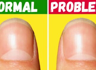 13 Probleme de sănătate, pe care ni le dezvăluie forma semilunii de pe unghii
