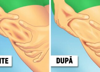 Dermatologii împărtășesc sfaturi care chiar funcționează pentru a reduce celulita