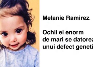 14 persoane ale căror înfățișare este atât de uluitoare încât au devenit faimoase