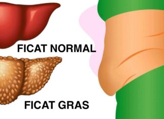 6 semne de avertizare care îți arată că ficatul tău este plin de toxine