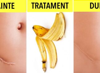 10 moduri neobișnuite de a folosi cojile de banane