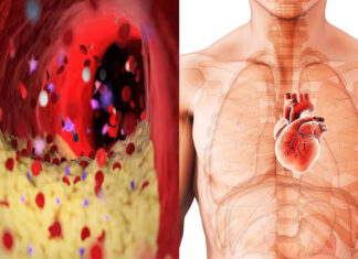 Cardiologii explică de ce sunt aceste 5 alimente rele pentru sănătatea inimii tale
