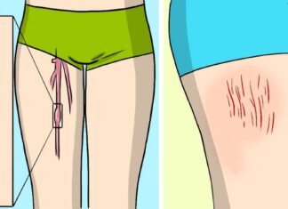 10 semne de avertizare ale unui cheag de sânge care nu pot fi ignorate