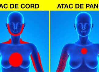 4 moduri de a deosebi un atac de cord de un atac de panică
