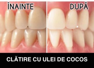 7 Motive pentru care ar trebui să începi să-ți clătești gura cu ulei de cocos