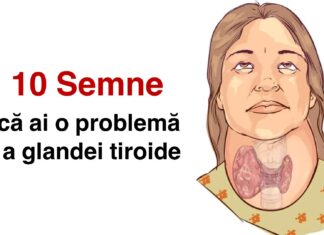 10 Semne că ai probleme cu tiroida