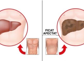 7 Semne de avertizare care indică deterioarea ficatului