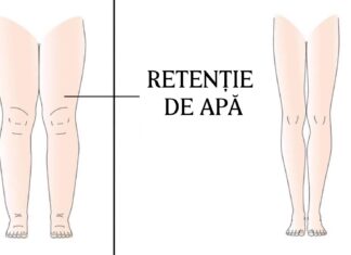 6 moduri simple de a reduce retenția de apă