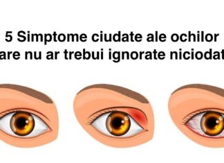 5 simptome ciudate ale ochilor. Nu le ignora niciodată deoarece ele pot semnala existența unei probleme grave
