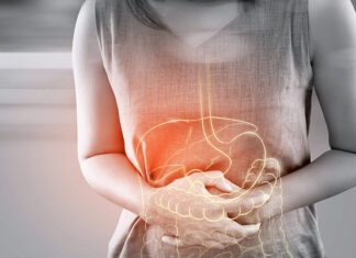 5 semne de cancer de colon pe care fiecare femeie ar trebui să le cunoască