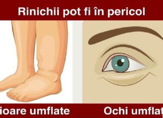 5 Semne de avertizare că rinichii tăi sunt în pericol