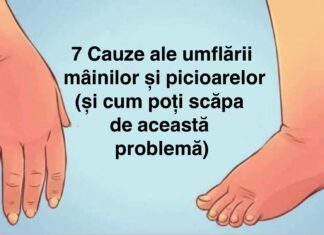 7 Cauze ale umflării mâinilor și picioarelor (și ce poți face pentru a scăpa de această problemă)