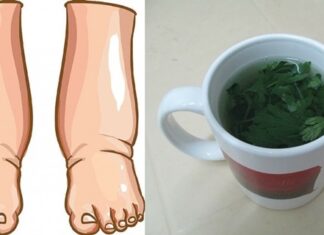 Un remediu natural puternic pentru a scăpa de picioarele umflate