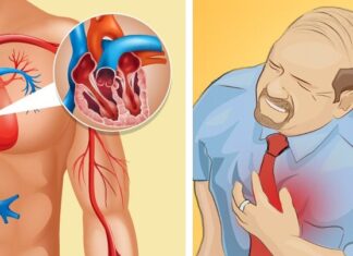 Cu o lună înainte de un infarct, corpul tău te va avertiza cu aceste 8 semne