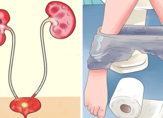 8 Remedii naturale eficiente pentru a scăpa de infecțiile tractului urinar (ITU)