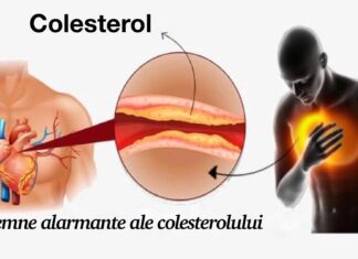 9 Semne de avertizare și simptome ale colesterolului ridicat pe care nu trebuie să le ignori niciodată