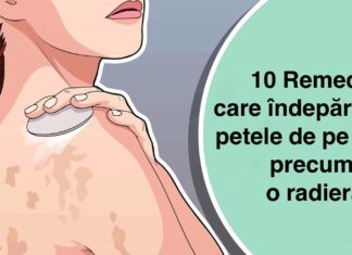 Top 10 remedii care îndepărtează petele de pe piele precum o radieră