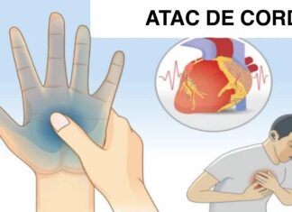 Corpul tău te va alerta cu aceste semnale cu o lună înainte de un atac de cord