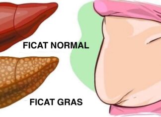 6 Semne de avertizare clare că ficatul tău este plin de toxine și te face să te îngrași (și cum să remediezi problema)