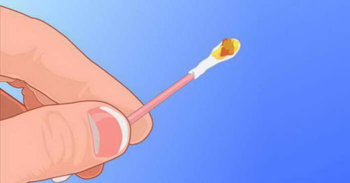 nature-of-ear-wax-about-health-00