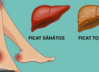10 Dintre cele mai periculoase toxine care vă afectează ficatul. Evită-le cât poți de des dacă vrei să ai un organism sănătos!