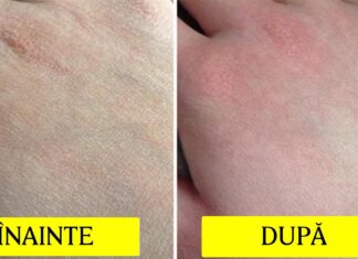 Multe femei subestimează aceste 4 uleiuri care sunt aur pentru piele (au proprietăți antiinflamatoare, de întinerire și luptă cu succes împotriva îmbătrânirii)