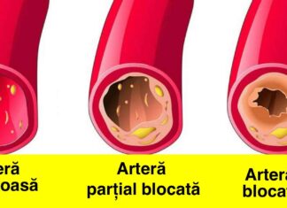 15 Alimente care vă curăța arterele și le mențin sănătoase. Consumați-le cât mai des!