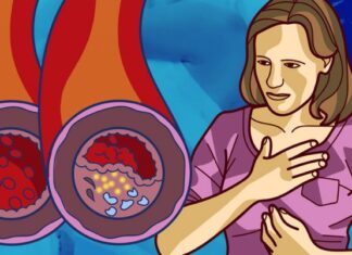 15 Alimente care îți curăță arterele, te ajută să lupți împotriva atacurilor de cord și să ai o inimă sănătoasă. Consumă-le cât mai des!