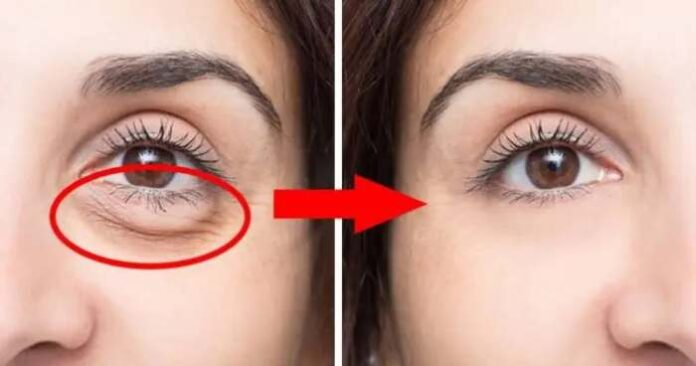 10-Natural-beauty-tips-to-look-younger-in-one-week