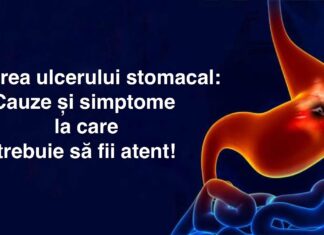 Tratarea ulcerului stomacal: Cauze și simptome la care trebuie să fii atent