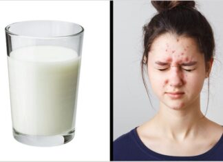 6 Obiceiuri alimentare care îți afectează pielea. Evită-le cât poți de mult!