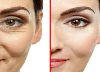 Cum să-ți faci botox natural cu doar trei ingrediente