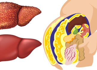 10 Alimente care stimulează funcția ficatului și ajută la detoxifierea organismului