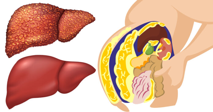 food-liver-detox-FI