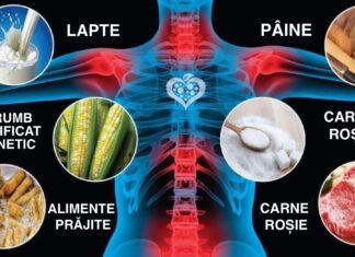 10 Alimente care provoacă inflamație cronică și declanșează durere, oboseală, balonare și alte probleme de sănătate. EVITĂ-LE CÂT POȚI DE DES!