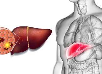 10 Semne că ficatul tău nu funcționează corect și 5 moduri de a-l vindeca în mod natural