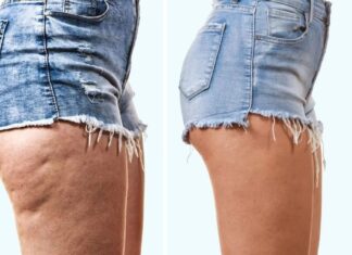 8 Moduri simple de a pierde grăsimea din zona coapselor