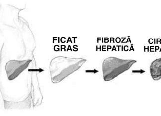 Simptomele ficatului gras și o rețetă eficientă pentru prevenirea acestei boli