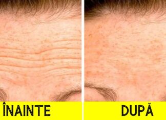 5 Remedii naturale eficiente pentru a vă face ridurile frunții mai puțin vizibile