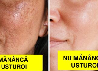 Ce cauzează pigmentarea pielii și cum să o eviți sau să o reduci