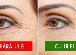 6 Uleiuri care luptă împotriva ridurilor tale