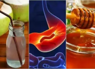 Vindecă-ți gastrita cu aceste 7 remedii naturiste