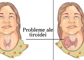 14 Semne că tiroida ta nu funcționează corect și cum să o ajuți