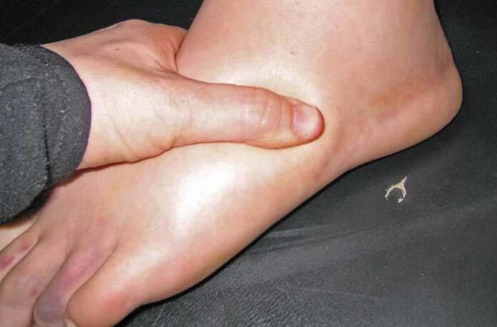 remedy-for-feet-swelling-850x560-1