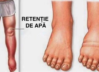 7 Alimente și băuturi care te pot scăpa de retenția de apă