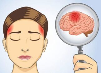 Nu ignora niciodată cele 6 simptome ale unui accident vascular cerebral