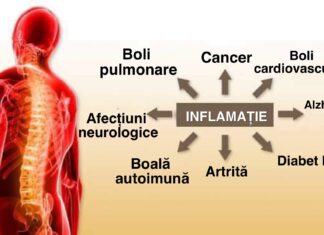 9 Pași simpli pentru a pune capăt rapid inflamației din corpul tău