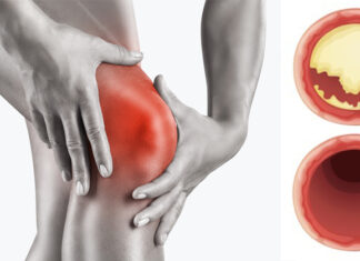 Cum să-ți potejezi organismul de inflamații, boli de inimă, accident vascular cerebal și diabet